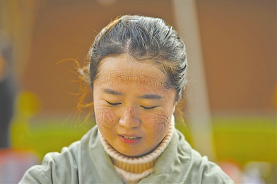 p 除去口罩等防护设备,张晶脸上的勒痕重重/p>