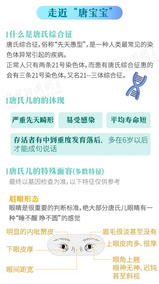 世界唐氏综合征日 一图科普唐氏儿